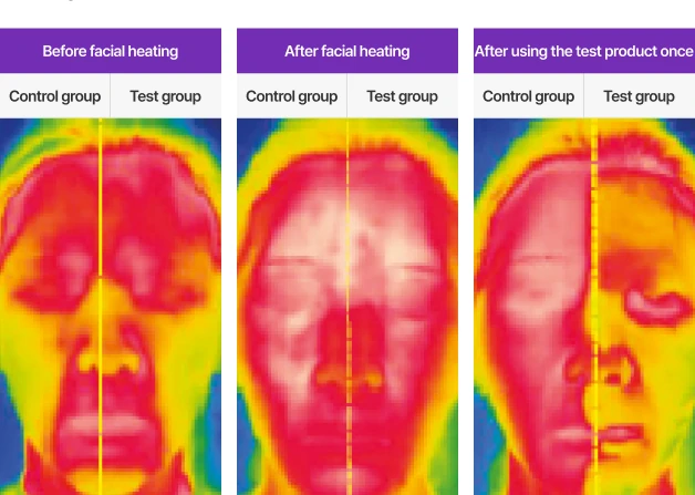 Thermal photographs of a face before facial heating, after facial heating, and after one use of the gel, control and test sides