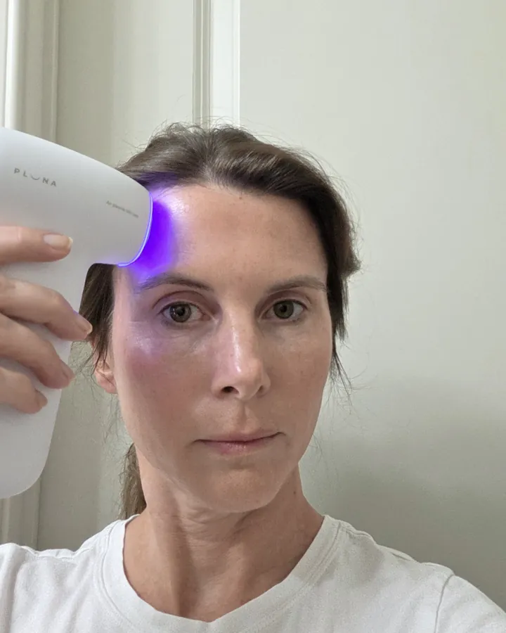 Sarah S. using PLUNA on her forehead